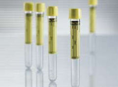 TUBE, VAC URINE 16X100 9.5ML NO BORIC (50/BX)