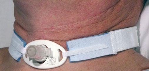 HOLDER, TRACH TUBE NEO (10/BX 10BX/CS)