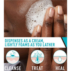 CERAVE ACNE, CRM FOAM CLNSR 5OZ
