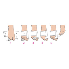 BUNION SPLINT SM/LFT SOFT POST OP