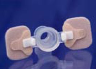 CLIP, CANNULA F/PROVOX LARYBUTTON (4 CLIP SETS/20 ADH BASE)