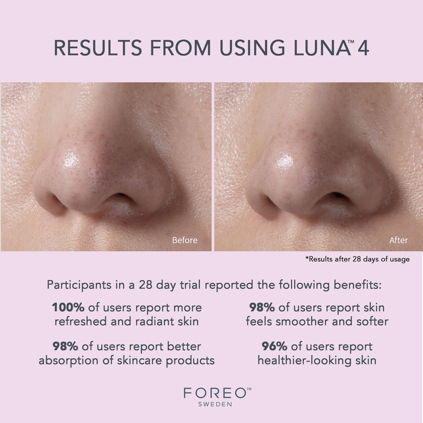 BRUSH/MASSAGE, FACE LUNA 4 T SONICTM SENSITIVE SKIN
