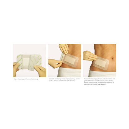 DRESSING, MEPORE PRO 9X15CM (40/BX 8BX/CS)