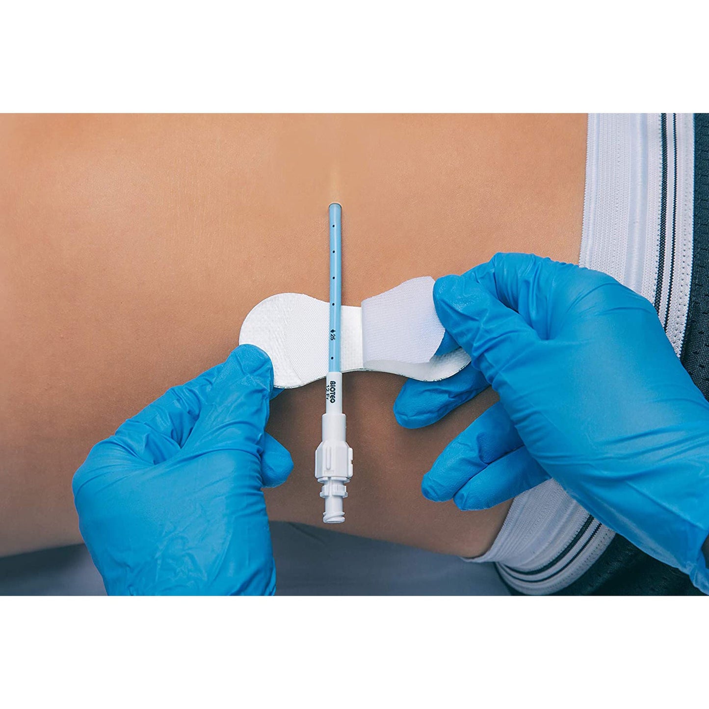 SECUREMENT, CATHETER/PICC GRIP-LOK MED (100/BX)