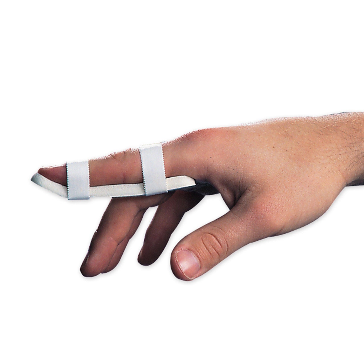 FINGER SPLINT KIT, PLASTALUME ALUM ASTD (27/BX)