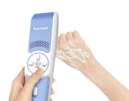 LIGHT, VEIN VIEWER INFRARED HND HELD