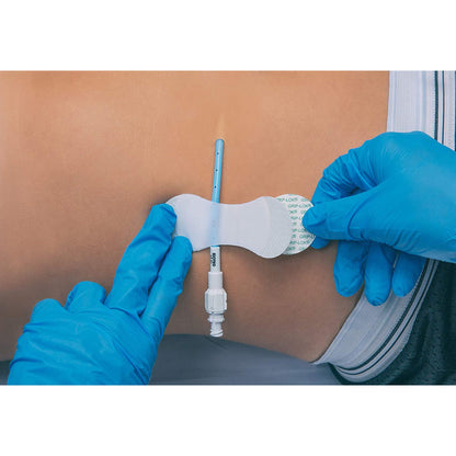 SECUREMENT, CATHETER/PICC GRIP-LOK MED (100/BX)