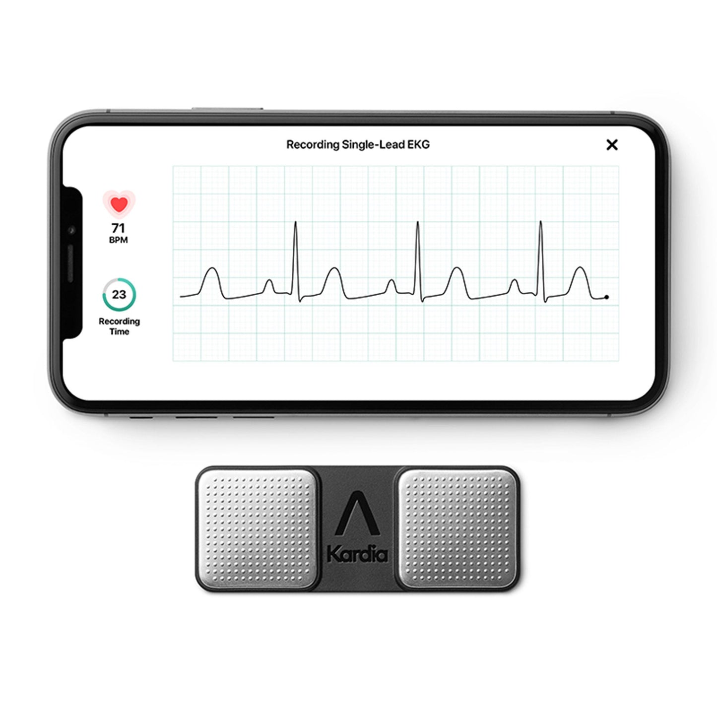 MONITOR, EKG KARDIA 1LEAD PORTPERSONAL (1/PK 24PK/CS)