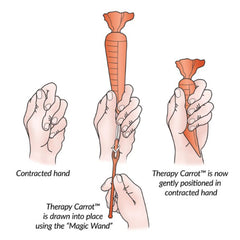 FINGER ORTHOSIS KIT, TCFO ORG SM D/S