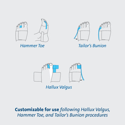 TOE SPLINT, ALIGNMENT (36/CS)