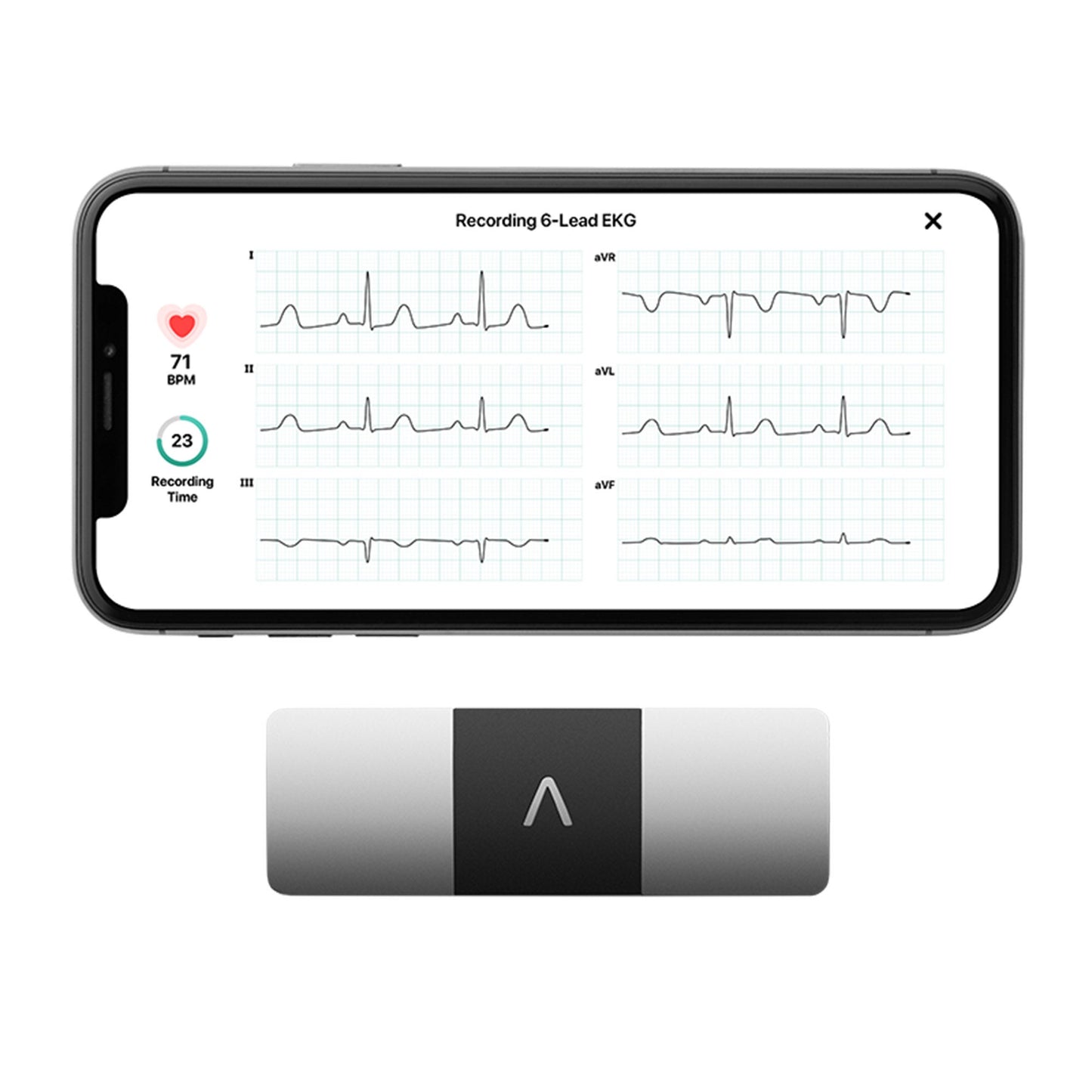 MONITOR, EKG KARDIA 6LEAD PORTPERSONAL (1/PK 24PK/CS)