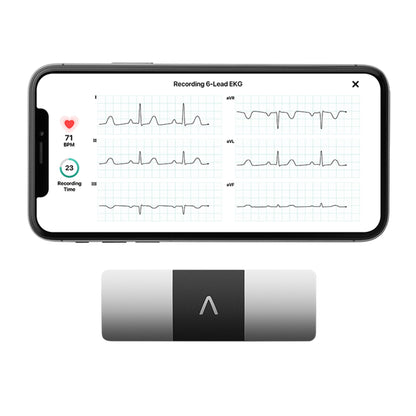 MONITOR, EKG KARDIA 6LEAD PORTPERSONAL (1/PK 24PK/CS)