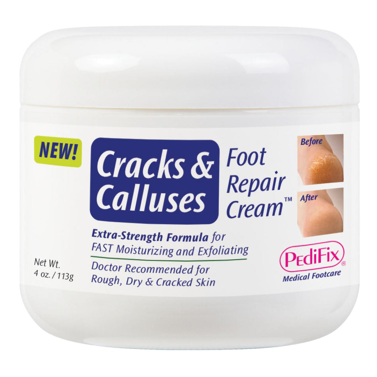 CREAM, CRACKS/CALLUSES FOOT REPAIR 4OZ