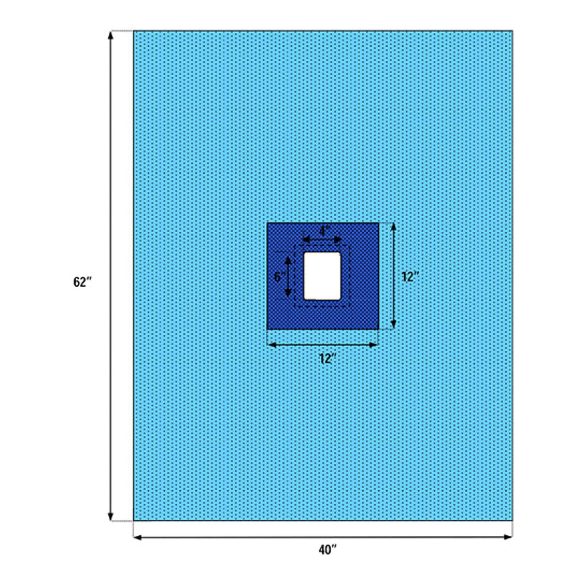 DRAPE, SURG FENSTD STR BLU 40X60 (60/CS)