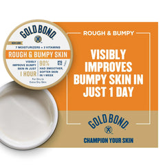 GOLD BOND, CRM ROUGH/BUMPY SKIN 8OZ