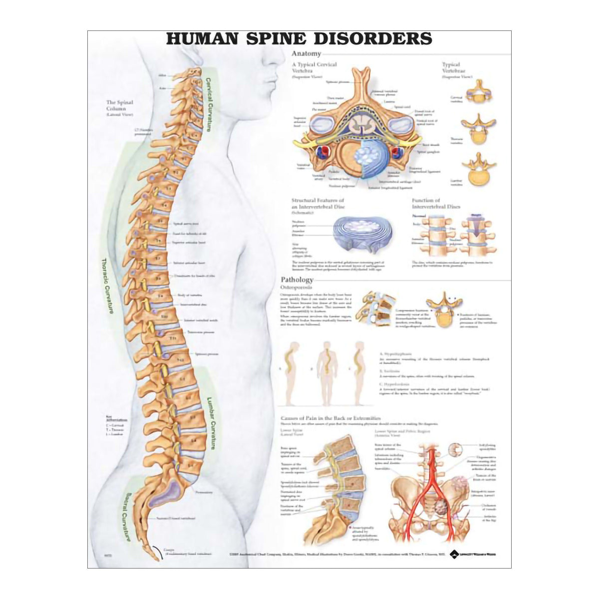 CHART, SPINE