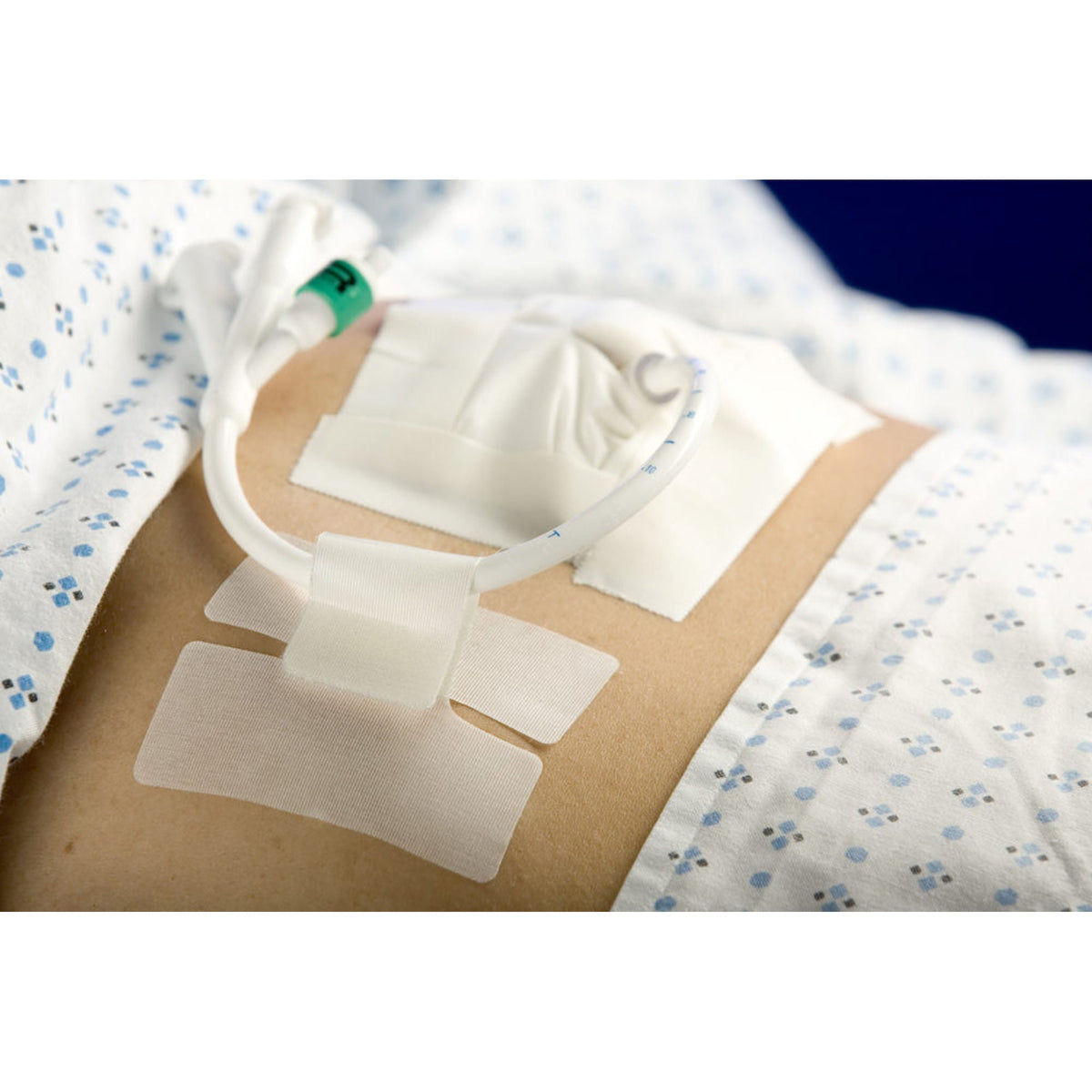 CATH-SECURE, (50/BX)