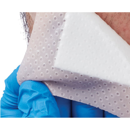DRESSING, WOUND FM ADVAZORB 3.9X3.9 (10/X)