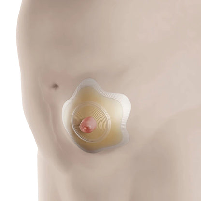 BARRIER, OSTOMY SENSURA MIO CLICK 2PC RED 1 3/8" (5/BX)