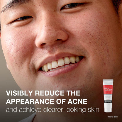 NEUTROGENA, GEL ACNE SPOT TRTMT RAPID CLR 1OZ