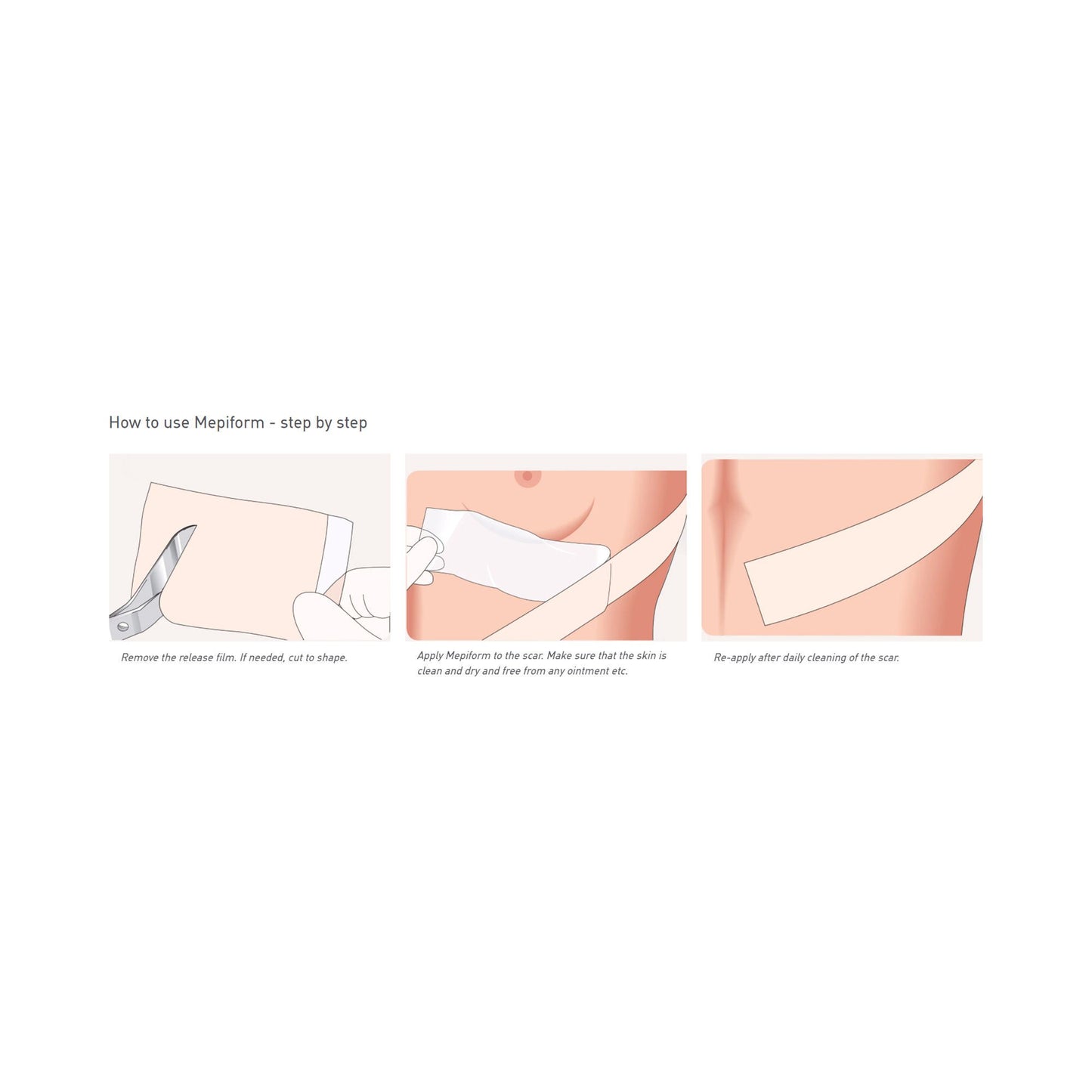 DRESSING, MEPIFORM 4X7" (5/BX 7BX/CS)