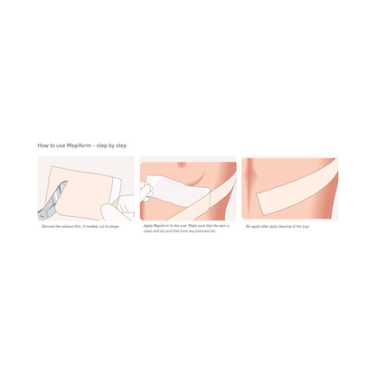 DRESSING, MEPIFORM 4X7" (5/BX 7BX/CS)
