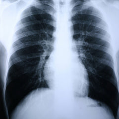 FILM, XRAY GRN 8X10 (100/BX)