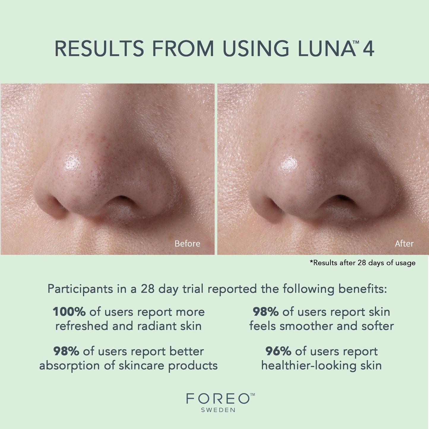 BRUSH, MASSAGE LUNA 4 FACIAL TSONICTM CLEANSE/FIRMING