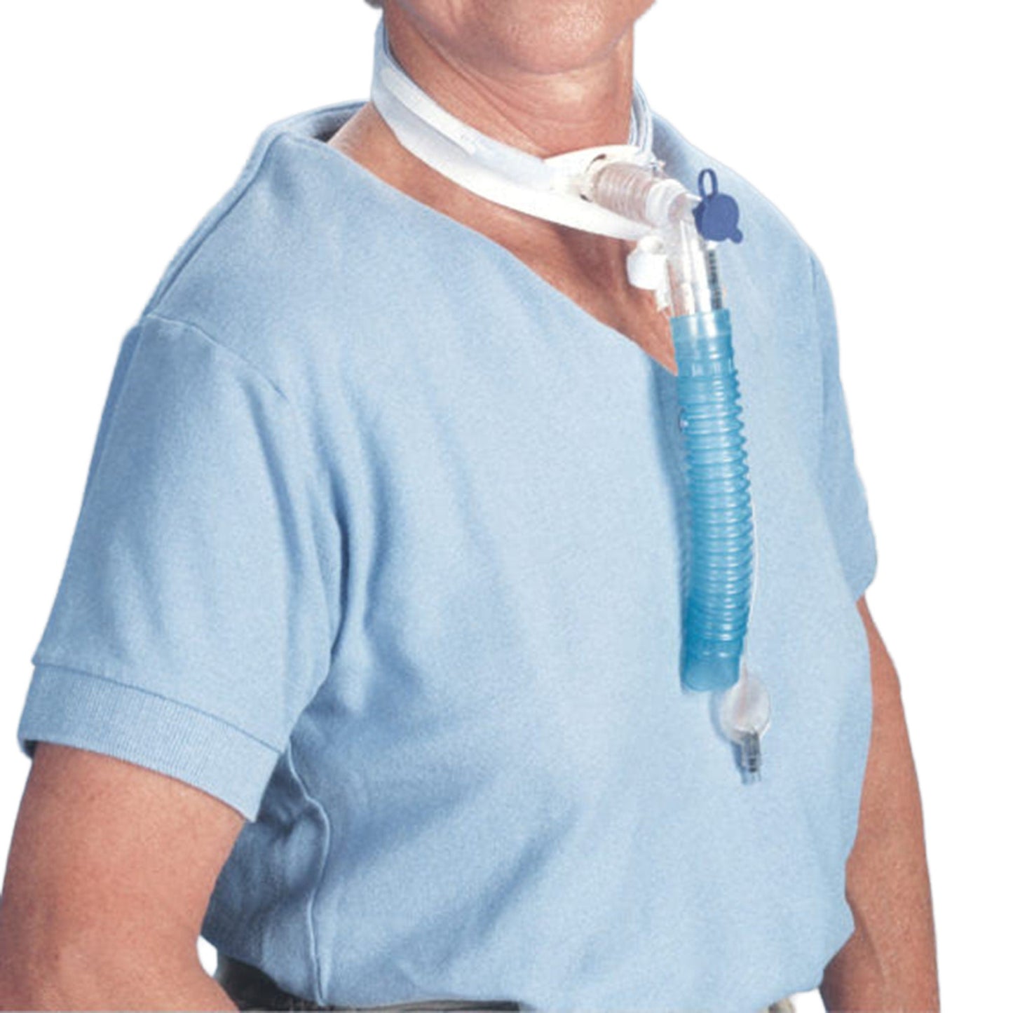 TIE, TRACH TUBE SECURE LG (12/DZ) POSEY
