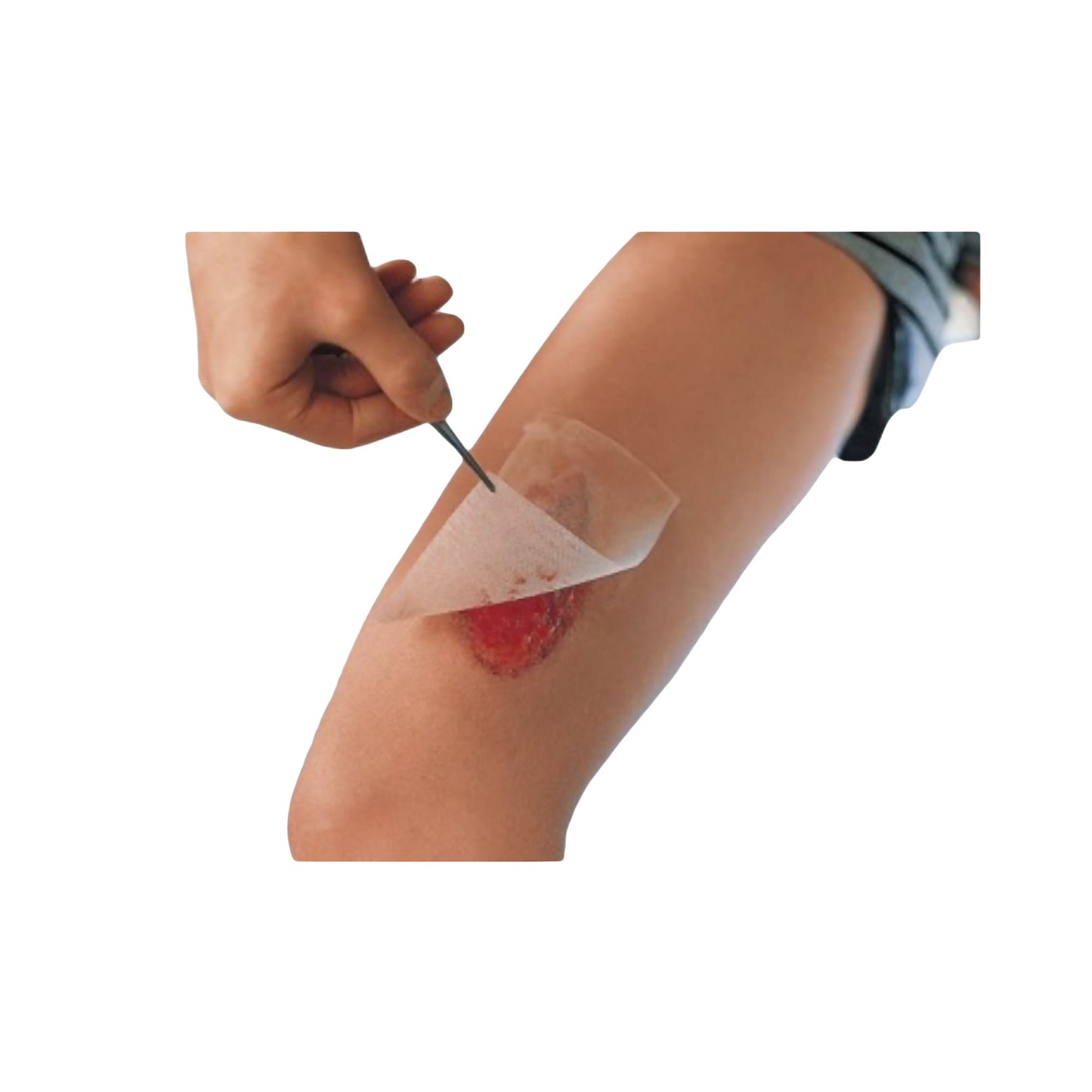 DRESSING, CUTICERIN GAUZE 3"X8" (25/BX 6BX/CS)