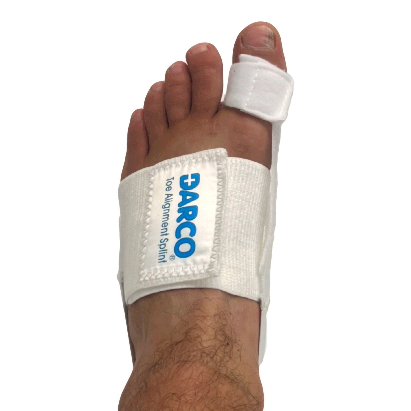TOE SPLINT, ALIGNMENT (36/CS)