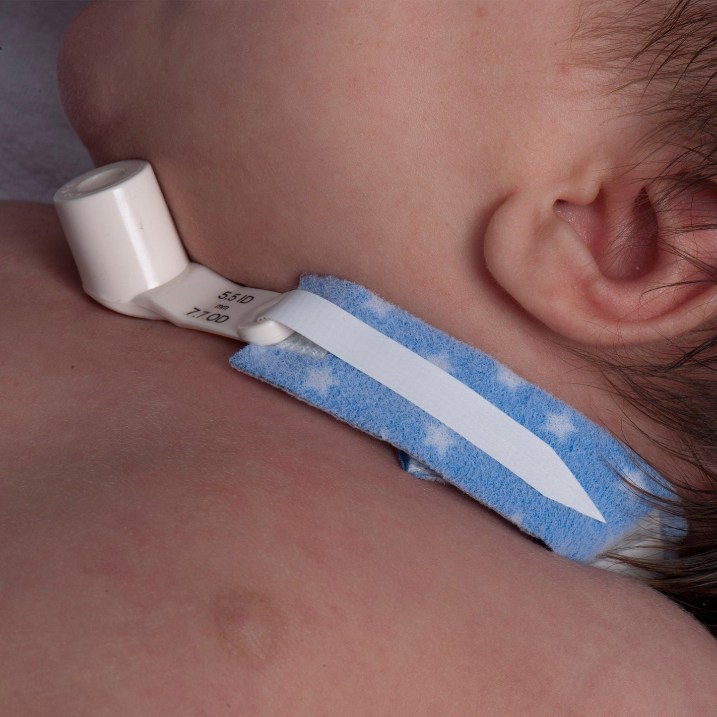 TRACH HOLDER, NEONATE 9" (10/BX)