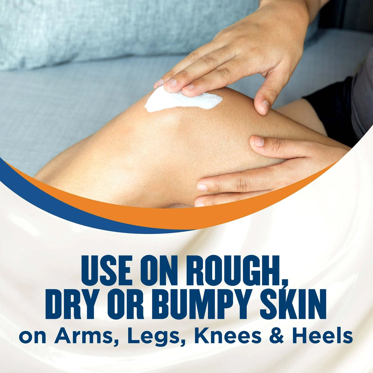 GOLD BOND, CRM ROUGH/BUMPY SKIN 8OZ