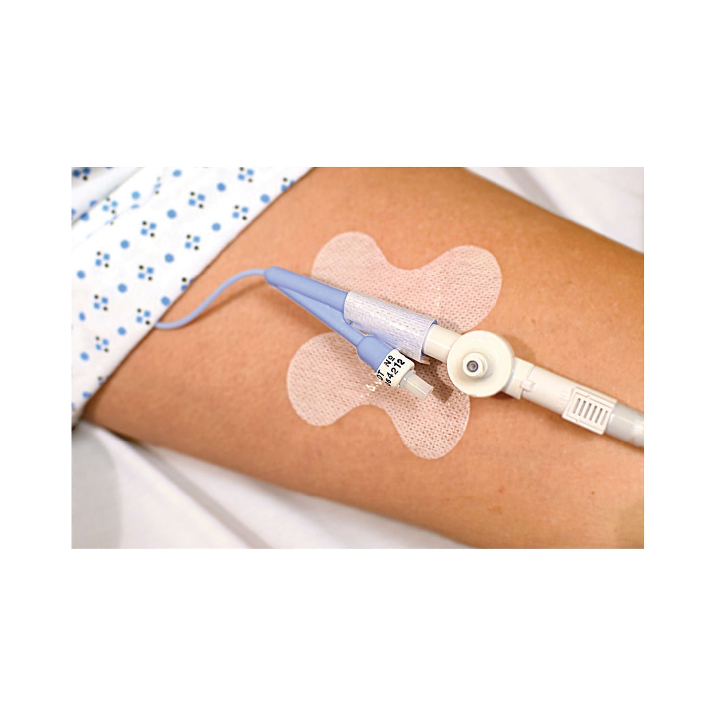 HOLDER, CATH 2 1/2" W/BUTTERFLY BASE (50/BX)