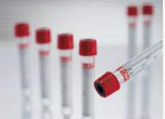 TUBE, BLD COL CLOT RED/BLK 9MLPET VACUETTE (50/PK 24PK/CS)