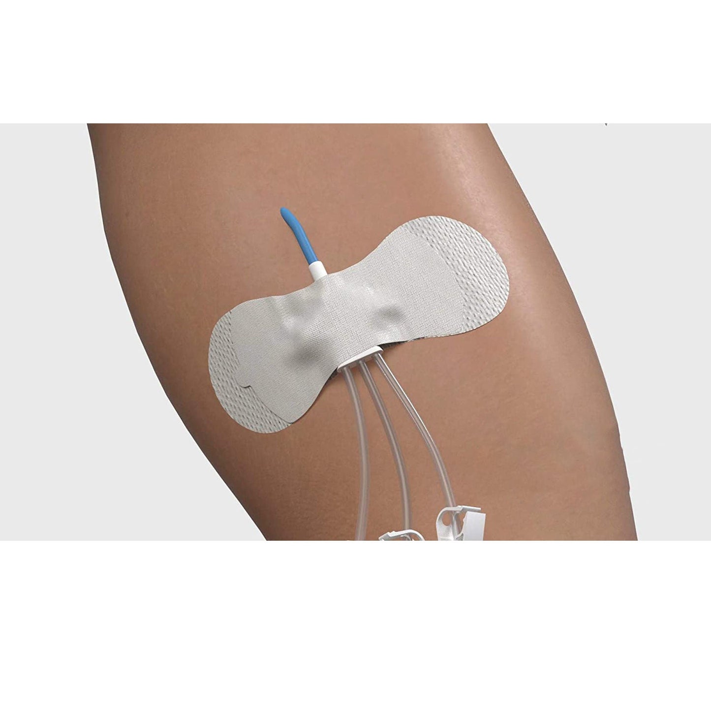 SECUREMENT, CATHETER/PICC GRIP-LOK MED (100/BX)