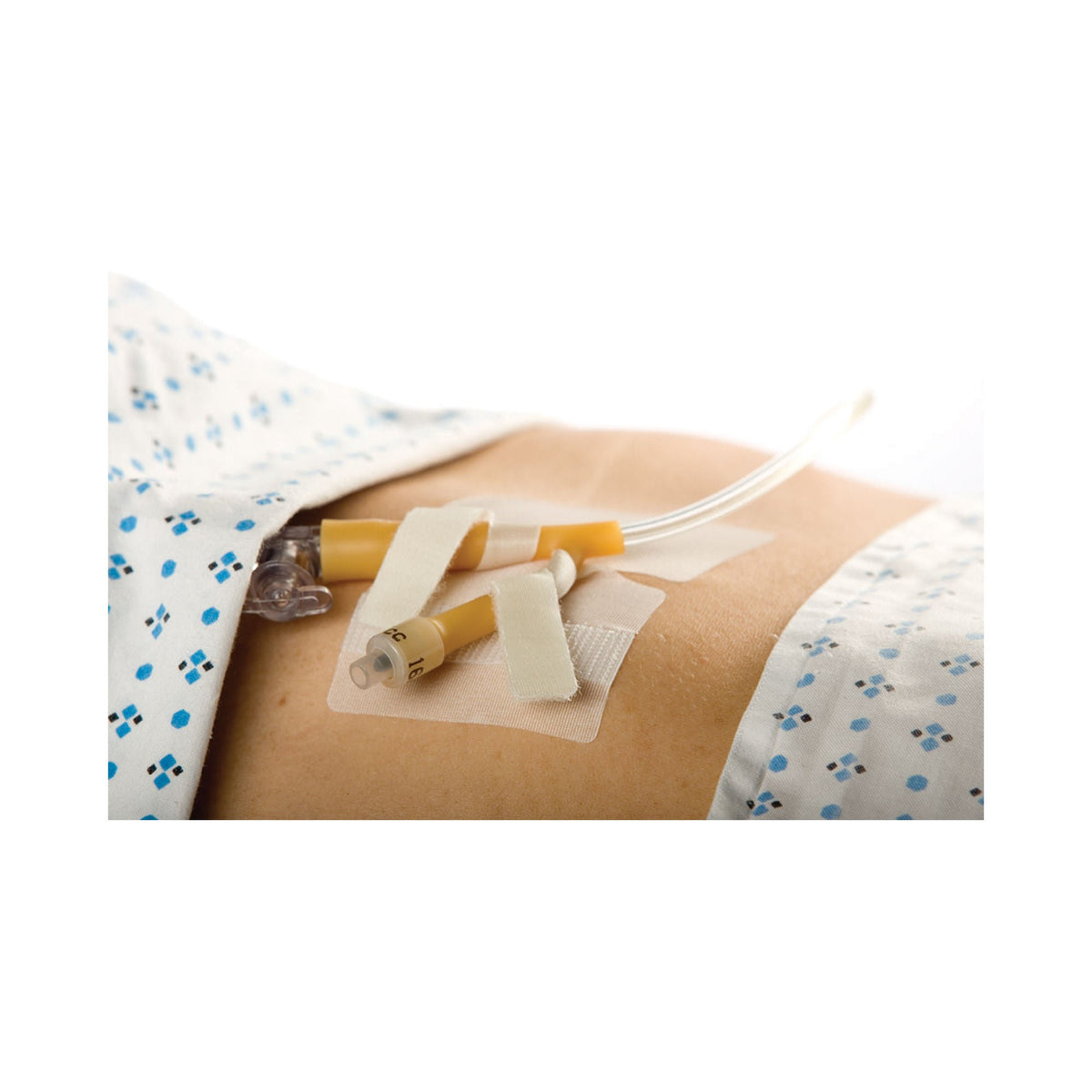 SECURE TAB, CATH DUAL 3X3" (50/BX 8BX/CS)