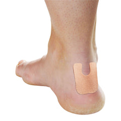 CALLUS PROTECTOR, FELT (8/PK)