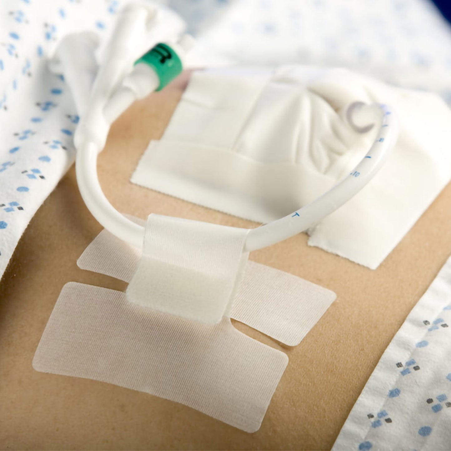 HOLDER, TUBE CATH-SECURE (50/BX 8BX/CS)