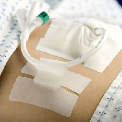 HOLDER, TUBE CATH-SECURE (50/BX 8BX/CS)