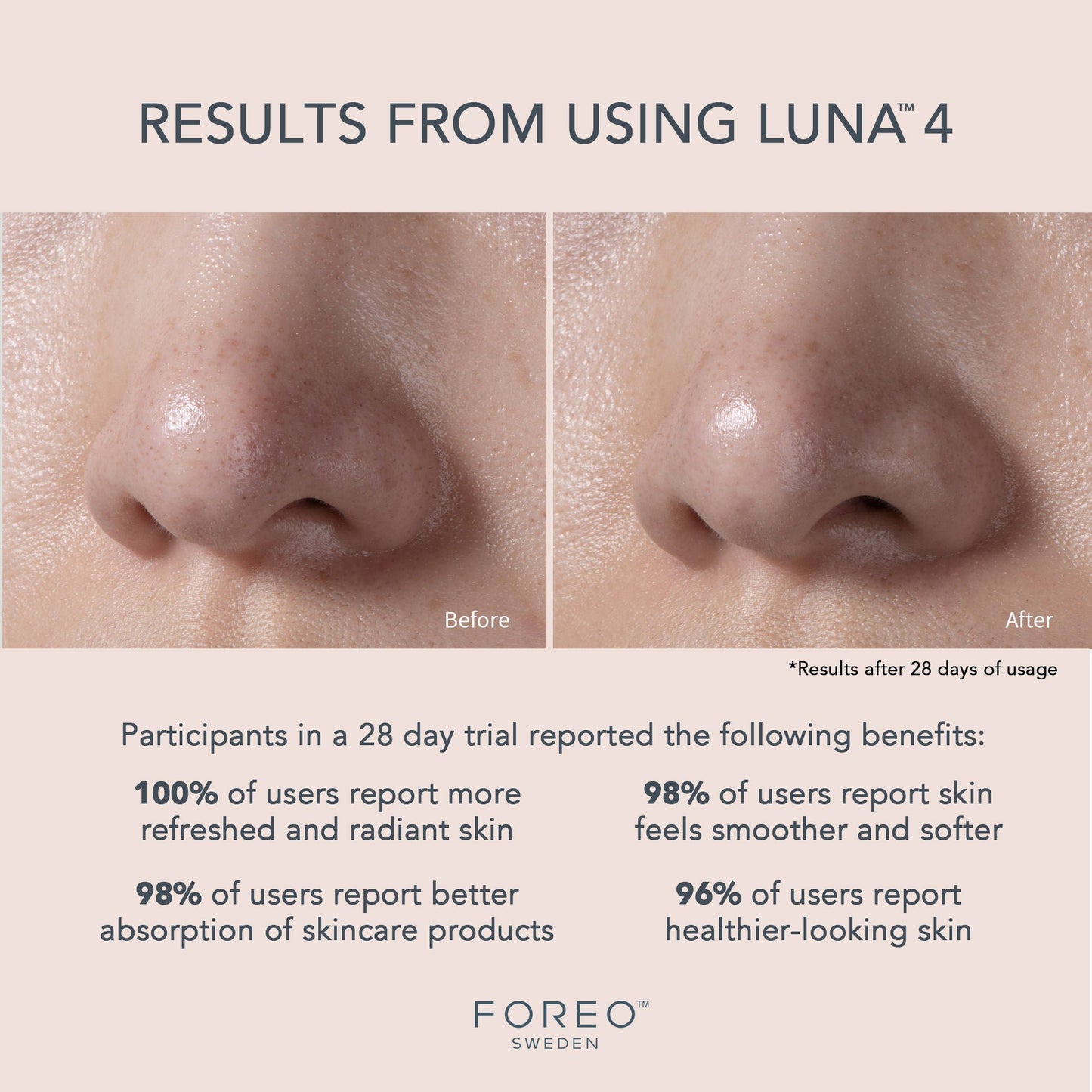 BRUSH, MASSAGE LUNA 4 FACIAL TSONICTM CLEANSE/FIRMING